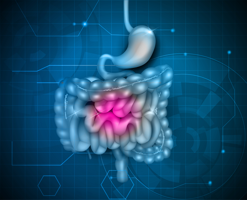 GIST Cancer- What it is and what are its risk factors